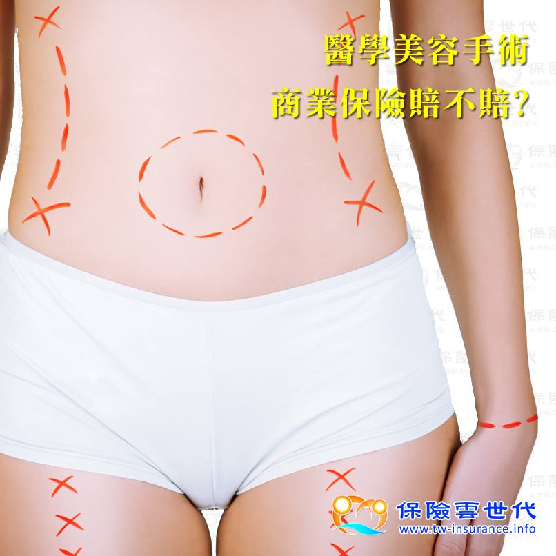 醫學美容手術  商業保險賠不賠?